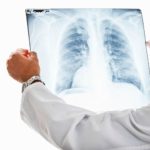 Как передается туберкулез
