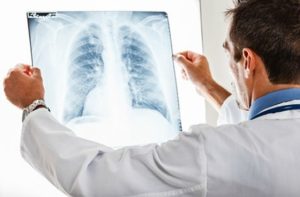 Как вылечить туберкулез открытой формы