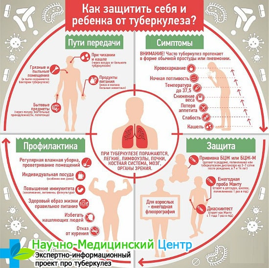 Туберкулез после пневмонии у детей