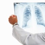 Туберкулез легких на рентгене