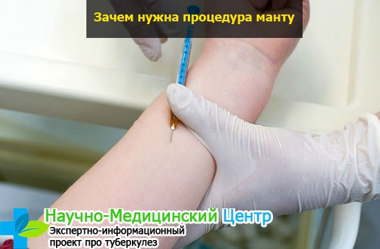 Прививка манту в каком возрасте делается