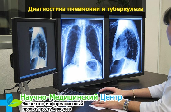 Подозрение на пневмонию или туберкулез