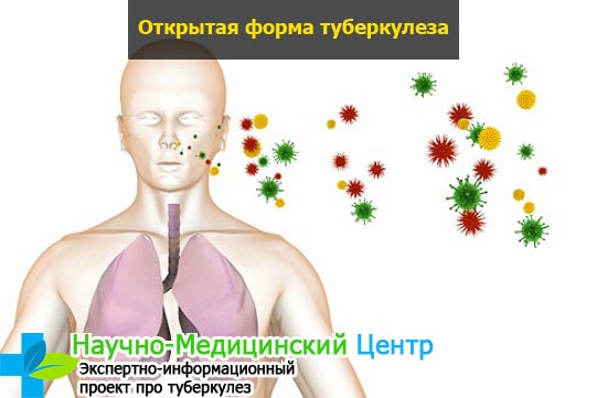Туберкулез как определить анализ крови