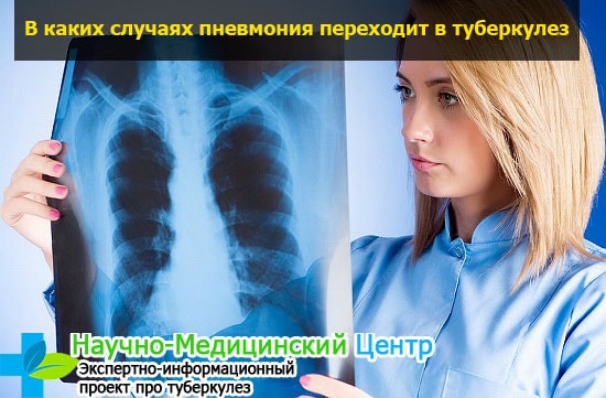 Пневмония подозрение на туберкулез признаки