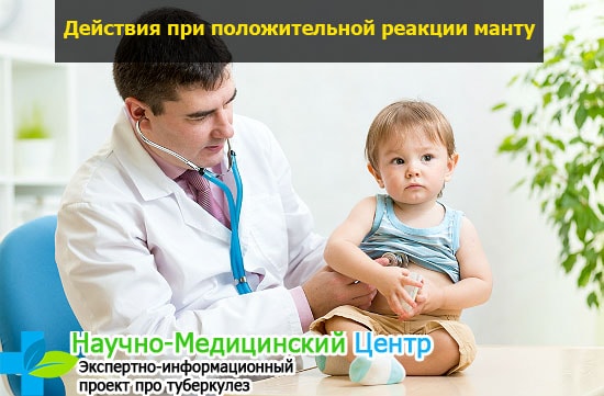 Возможная реакция на прививку манту у ребенка