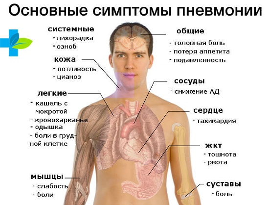 Чем опасна пневмония при туберкулезе